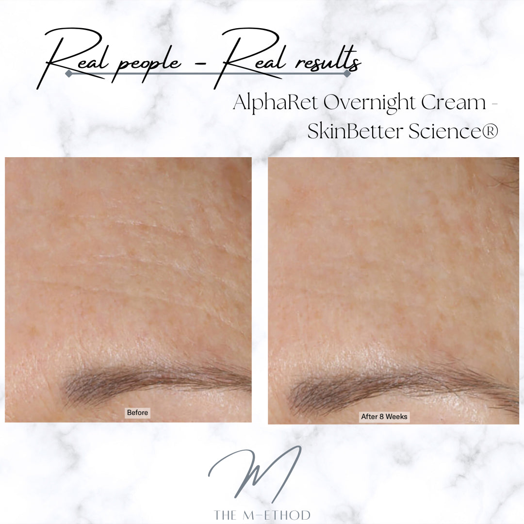 PHYSICAL - AlphaRet® Overnight Cream - SkinBetter Science