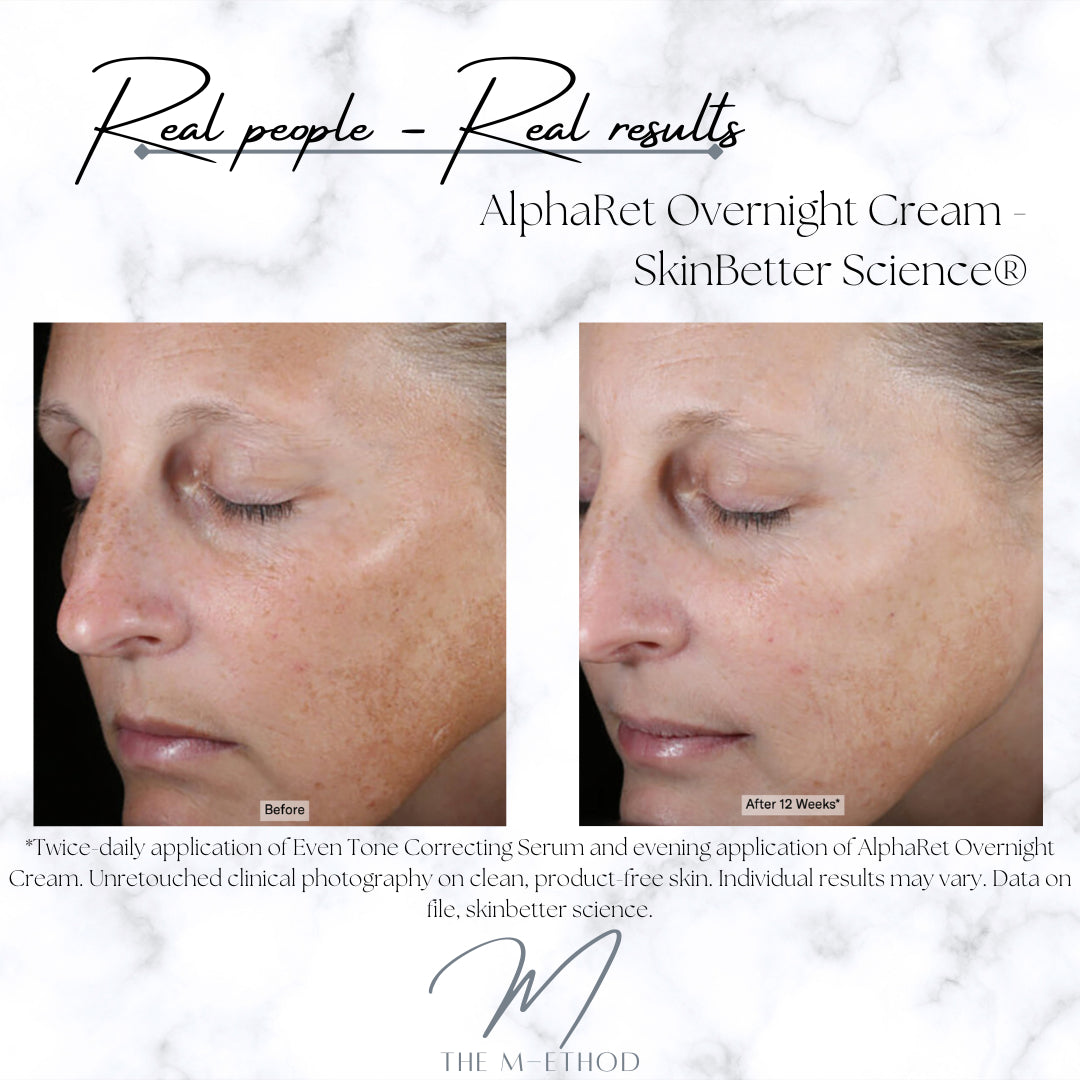 PHYSICAL - AlphaRet® Overnight Cream - SkinBetter Science