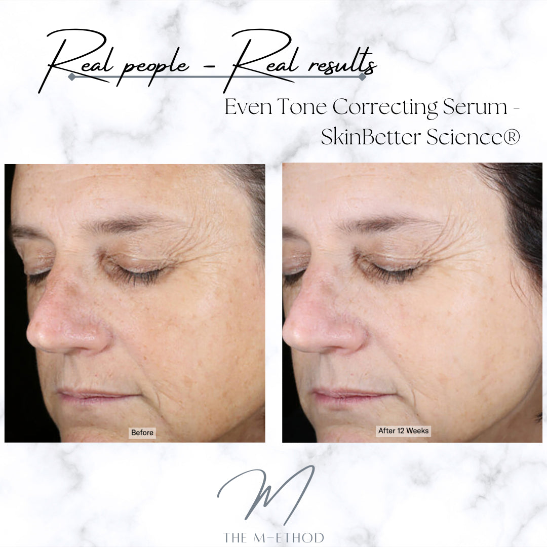 PHYSICAL - Even Tone Correcting Serum™ - SkinBetter Science