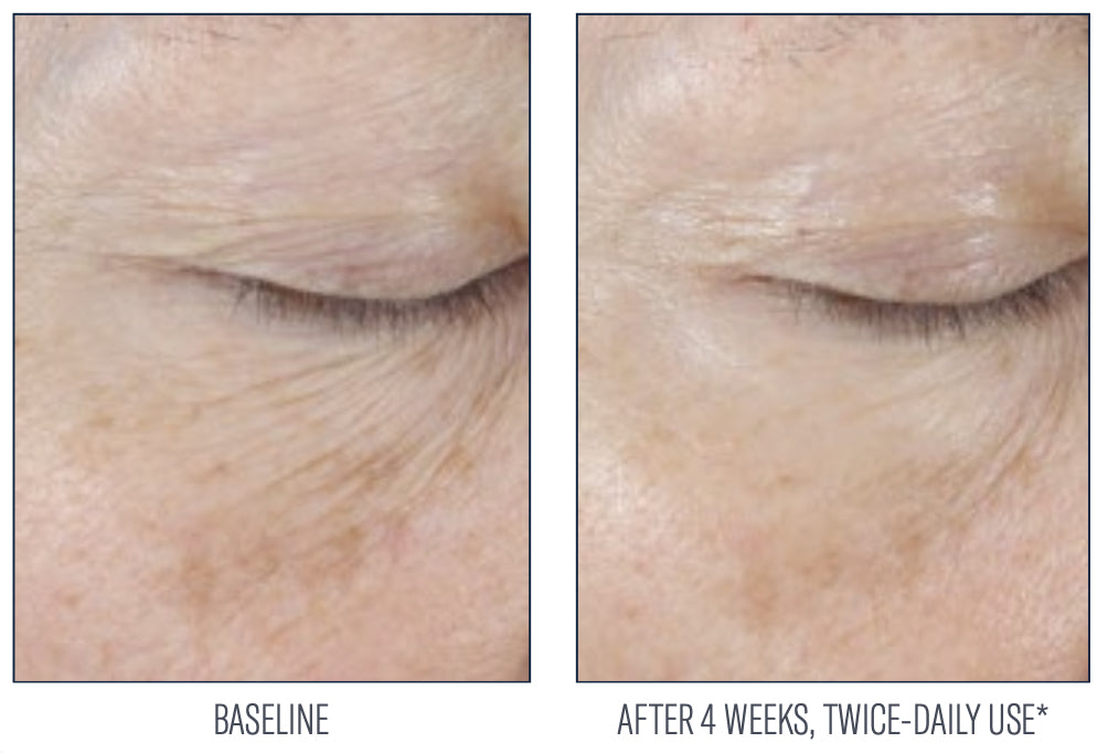 PHYSICAL - InterFuse® Intensive Treatment EYE - SkinBetter Science