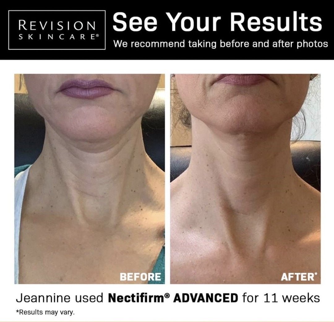 PHYSICAL - Nectifirm® ADVANCED - Revision Skincare