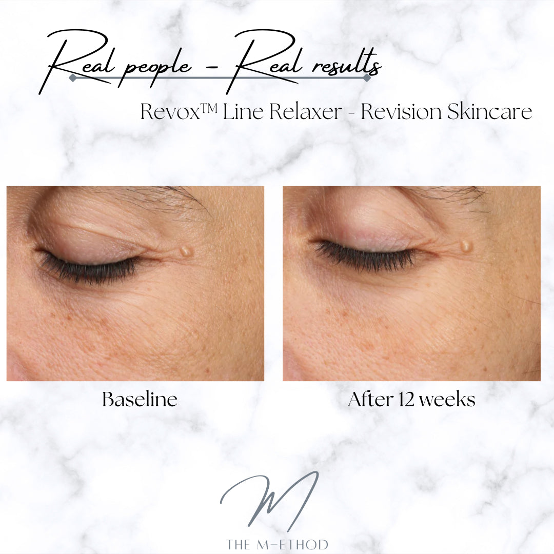 PHYSICAL - Revox™ Line Relaxer - Revision Skincare