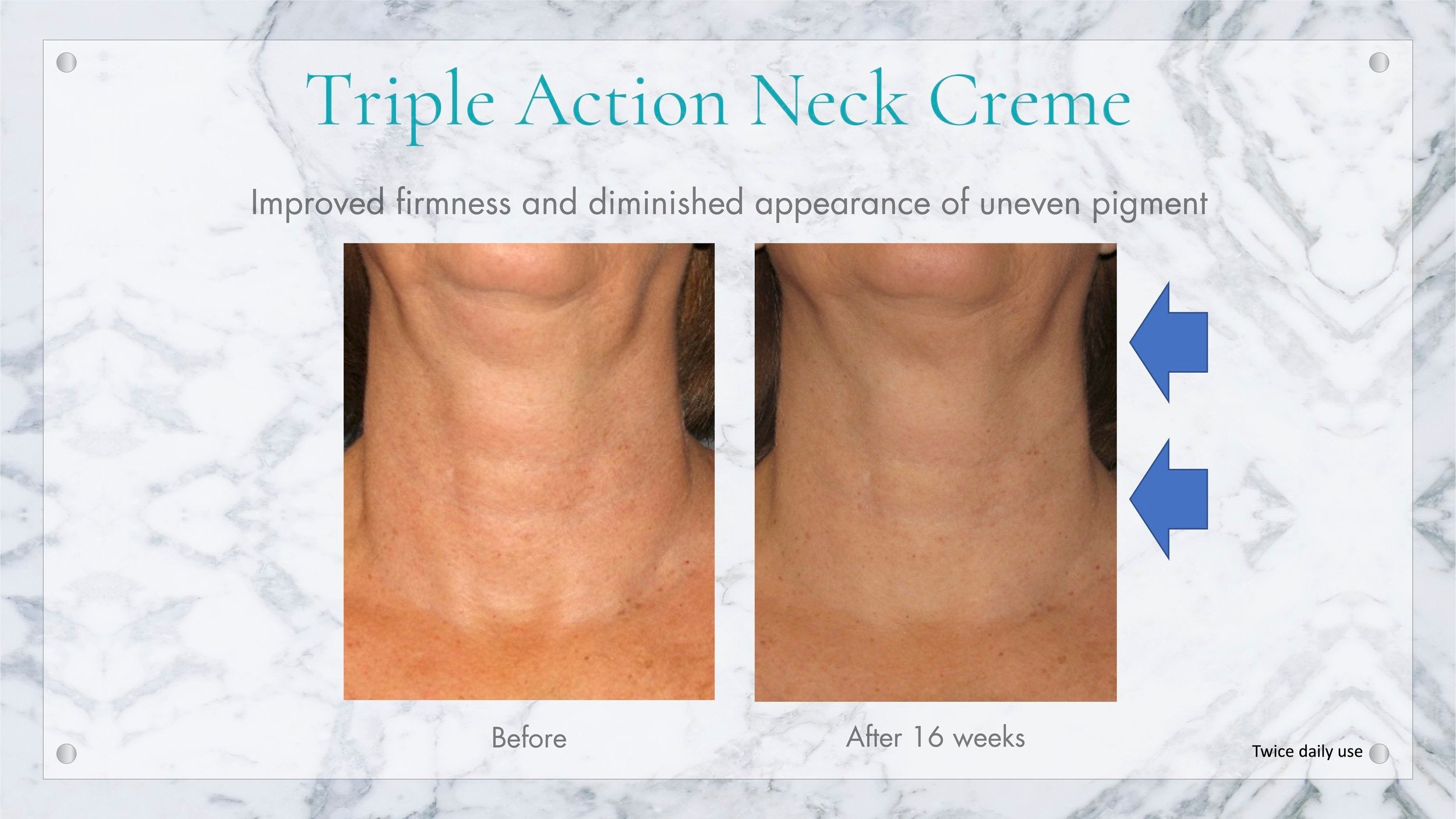PHYSICAL - Triple Action Neck Crème - Exuviance Professional